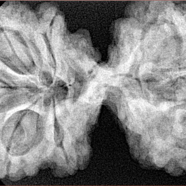 10 Mk Gaurishankar 43.4mm 10.56gm - Xray