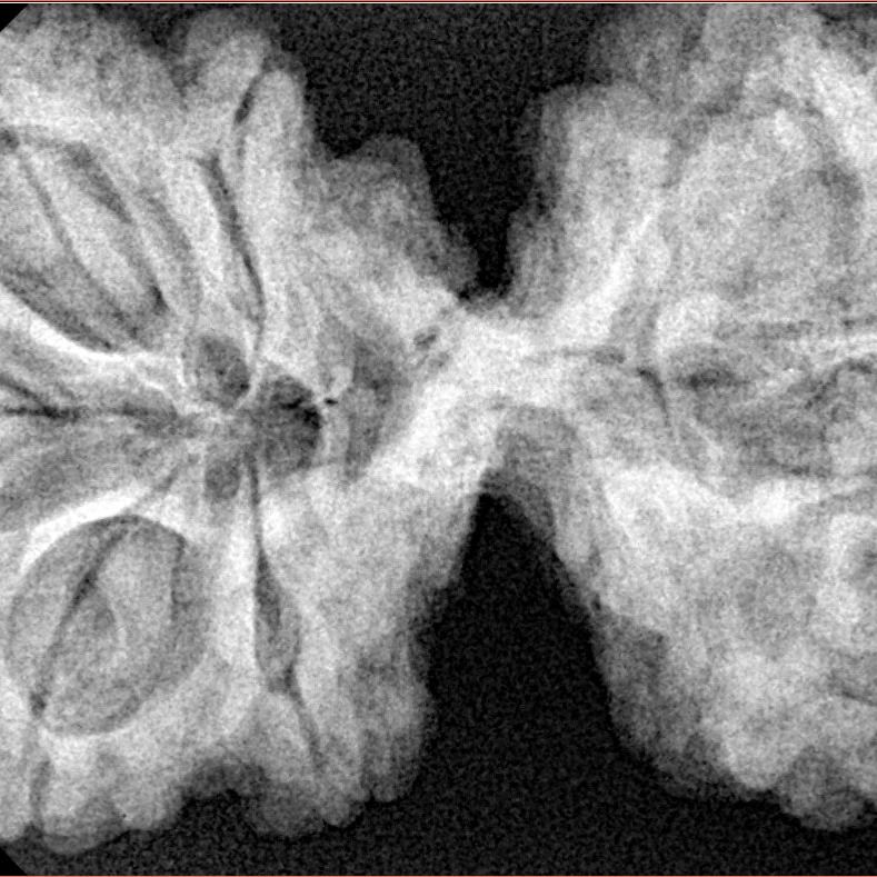 10 Mk Gaurishankar 43.4mm 10.56gm - Xray