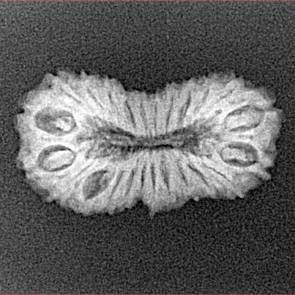24 Mukhi Rudraksha 23.5mm 1.8gm - Xray