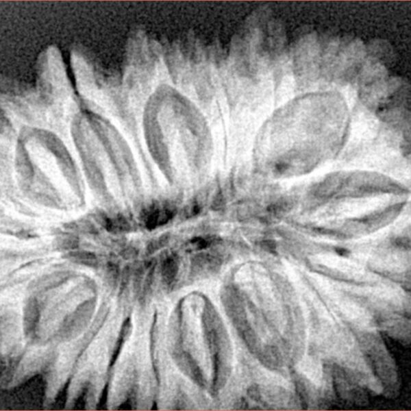 18 Mukhi Rudraksha 33.6mm 6.93gm - Xray