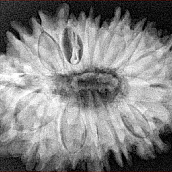 16 Mukhi Rudraksha 33mm 7.27gm - Xray
