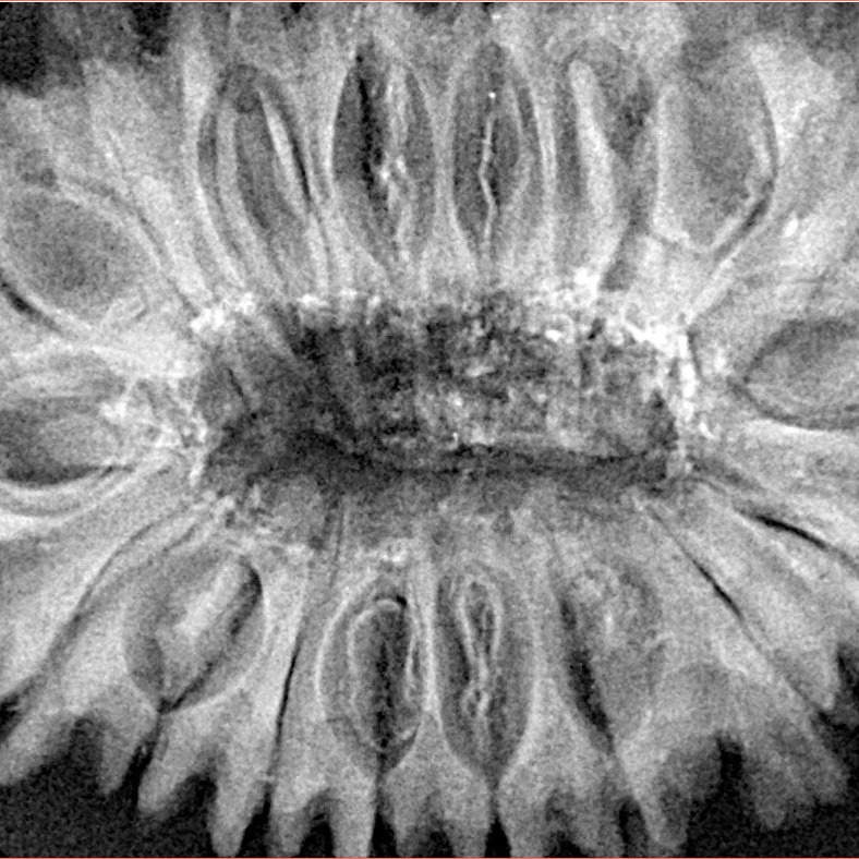 18 Mukhi Rudraksha 37.8mm 8.55gm - Xray