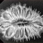 18 Mukhi Rudraksha 30.9mm 4.35gm - Origin: Nepal - Xray