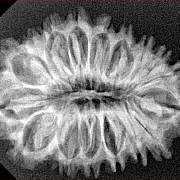 18 Mukhi Rudraksha 30.9mm 4.35gm - Origin: Nepal - Xray
