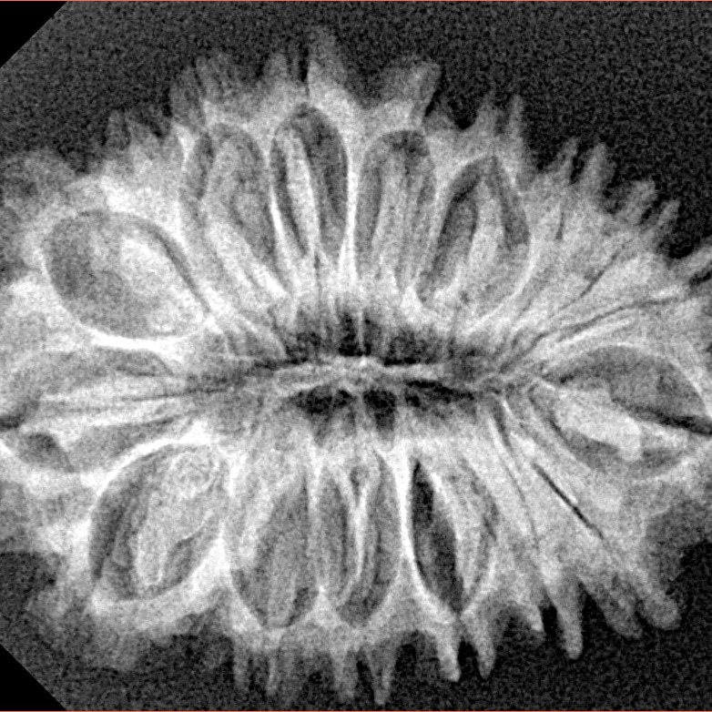 18 Mukhi Rudraksha 30.9mm 4.35gm - Origin: Nepal - Xray