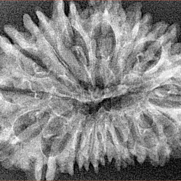 18 Mukhi Rudraksha 33.4mm 3.52gm - Origin: Nepal - Xray