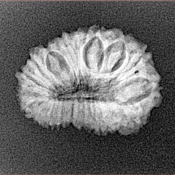 20 Mukhi Rudraksha 21.1mm 2gm - Xray