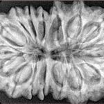 16 Mukhi Rudraksha 36.2mm 7.68gm - Xray