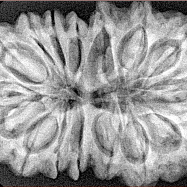 16 Mukhi Rudraksha 36.2mm 7.68gm - Xray