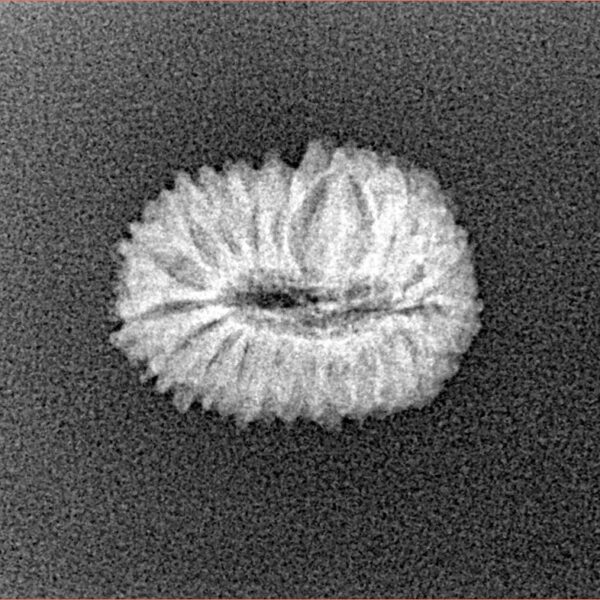 20 Mukhi Rudraksha 15.9mm 1gm - Xray