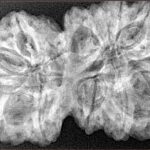 14 Mk Gaurishankar 38.6mm 7.72gm - Xray