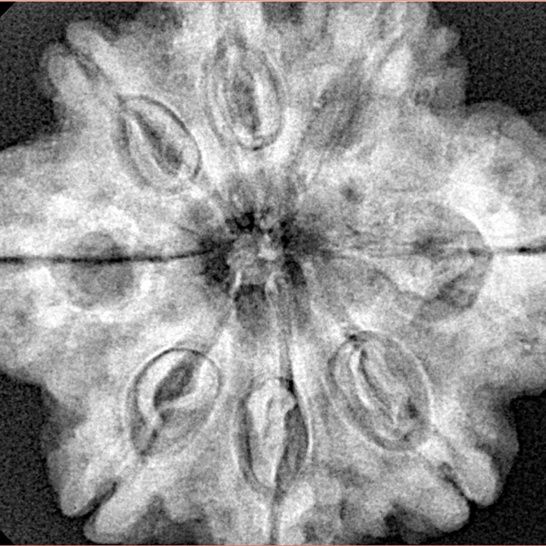 8 Mukhi Rudraksha 29.7mm 7.23gm - Xray