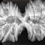 14 Mk Gaurishankar 38.4mm 8.58gm - Xray