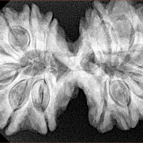 14 Mk Gaurishankar 38.4mm 8.58gm - Xray