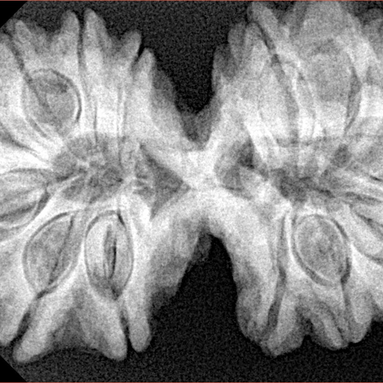 14 Mk Gaurishankar 38.4mm 8.58gm - Xray