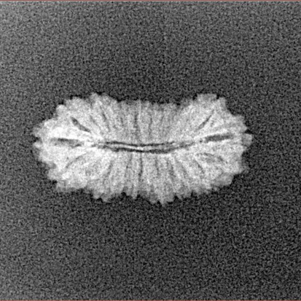 21 Mukhi Rudraksha 18.8mm 0.8gm - Xray