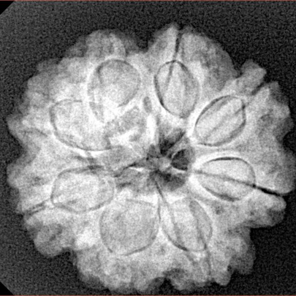 8 Mukhi Rudraksha 24.6mm 5.14gm - Xray
