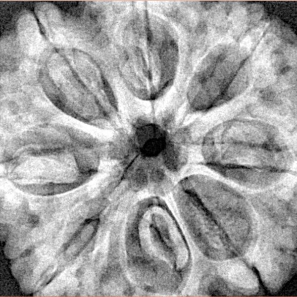 8 Mukhi Rudraksha 32.4mm 8.68gm - Xray