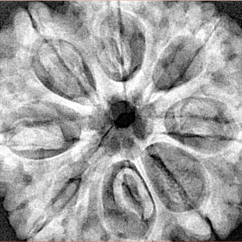 8 Mukhi Rudraksha 32.4mm 8.68gm - Xray
