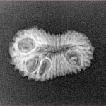 22 Mukhi Rudraksha 20.7mm 1.29gm - Xray