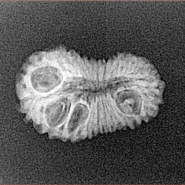 22 Mukhi Rudraksha 20.7mm 1.29gm - Xray