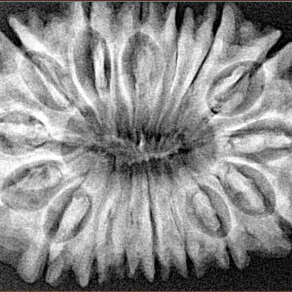 16 Mukhi Rudraksha 34.3mm 6.42gm - Xray