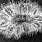 17 Mukhi Rudraksha 33.3mm 5.19gm - Xray