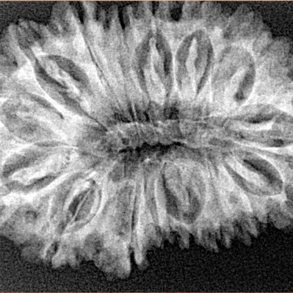 17 Mukhi Rudraksha 33.3mm 5.19gm - Xray