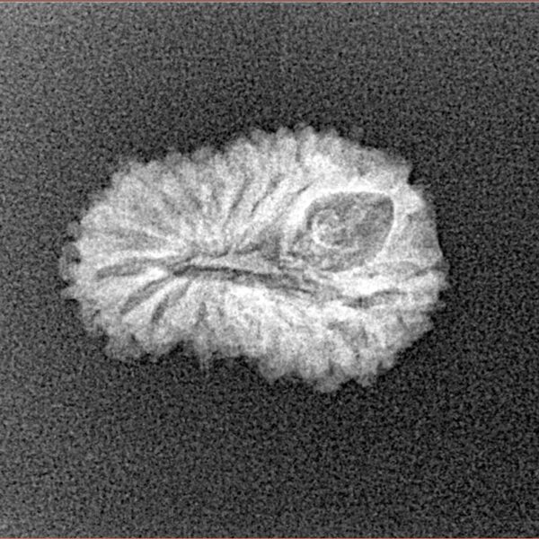 19 Mukhi Rudraksha 18.9mm 1.26gm - Xray