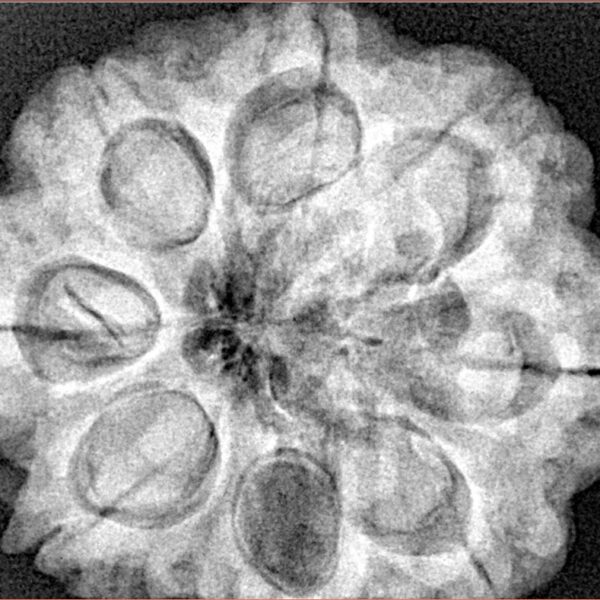 8 Mukhi Rudraksha 29.8mm 8.18gm - Xray