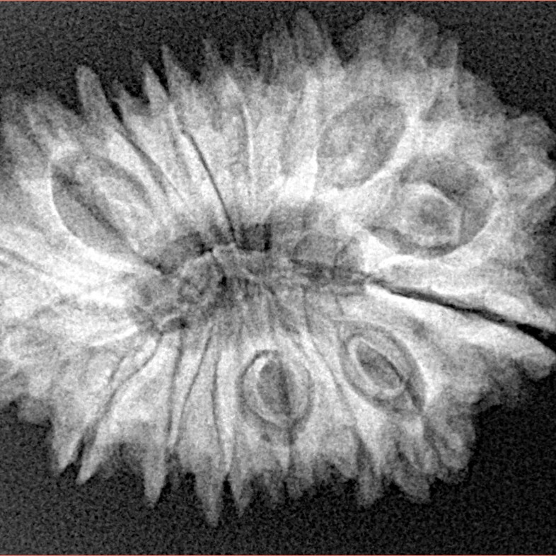 16 Mukhi Rudraksha 29.6mm 5gm - Xray