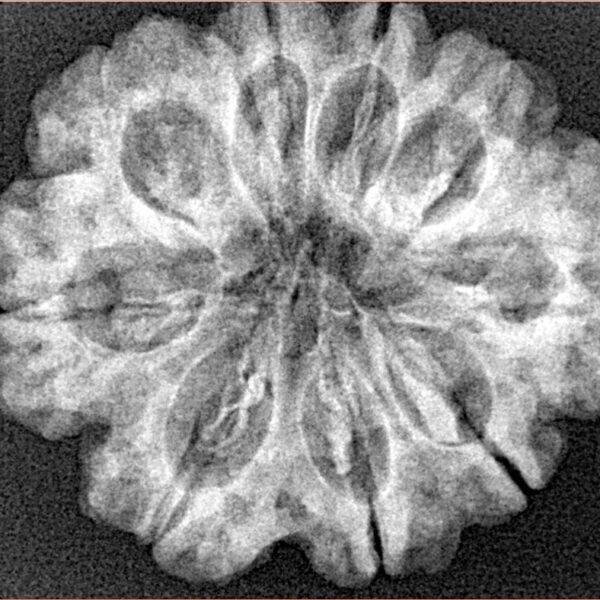 9 Mukhi Rudraksha 28.2mm 5.39gm - Xray