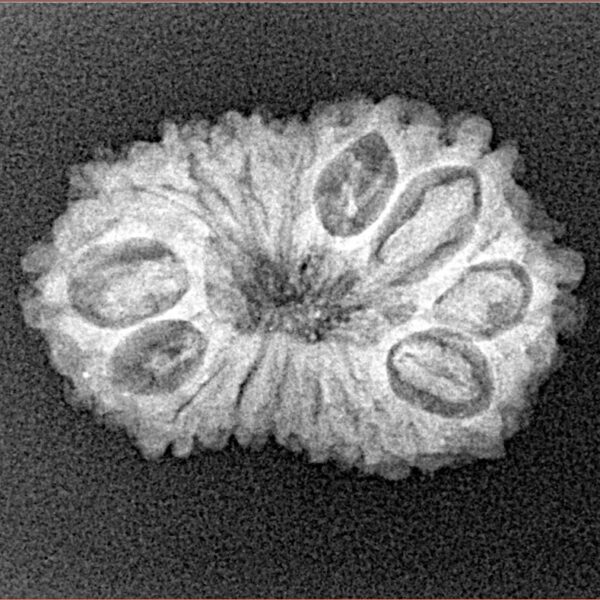 16 Mukhi Rudraksha 23.9mm 2.45gm - Xray