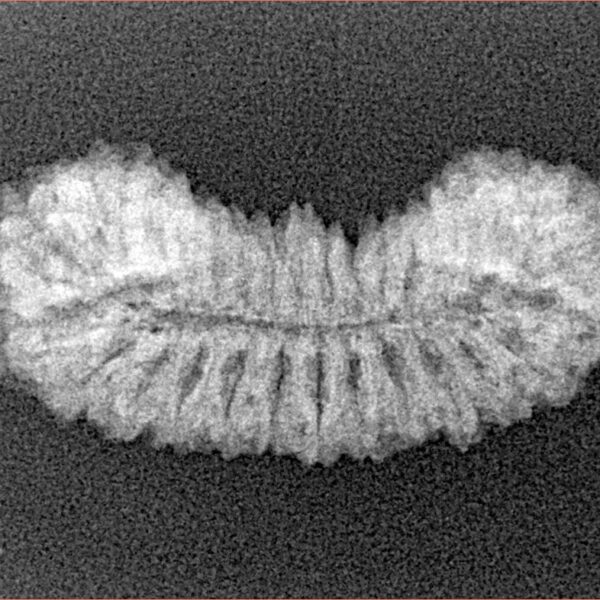 29 Mukhi Rudraksha 28.1mm 2.13gm - Xray