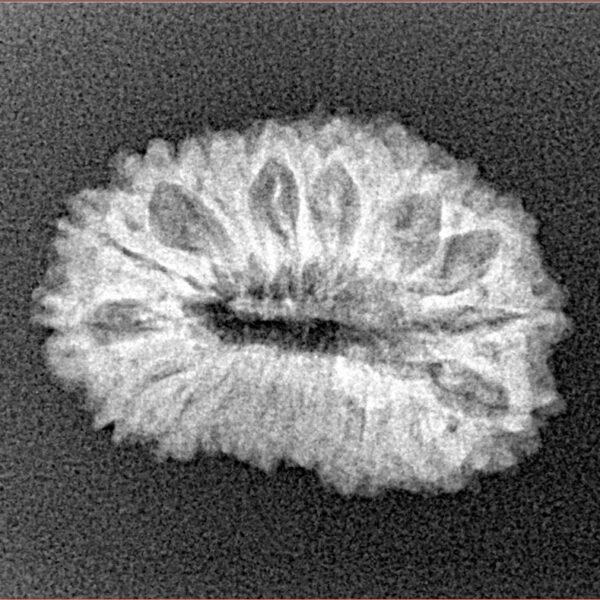 19 Mukhi Rudraksha 22.7mm 2.28gm - Xray