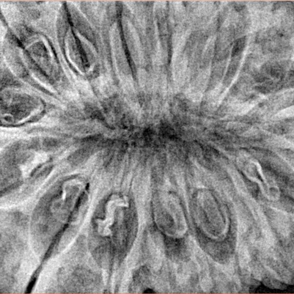 17 Mukhi Rudraksha 40.5mm 10.32gm - Xray