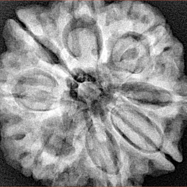 8 Mukhi Rudraksha 29.4mm 7.67gm - Xray