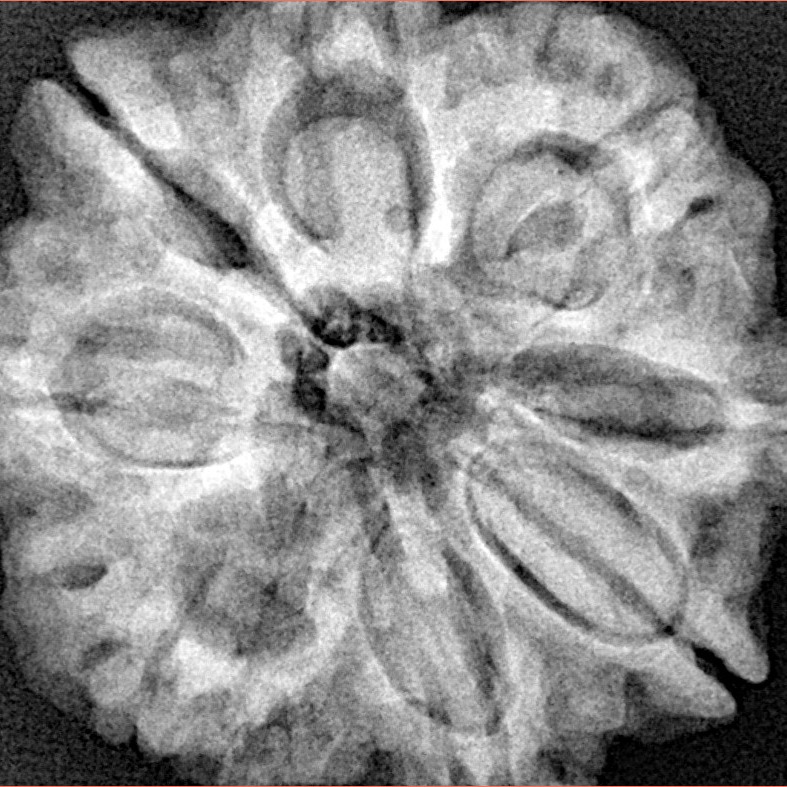 8 Mukhi Rudraksha 29.4mm 7.67gm - Xray