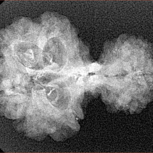 8 MK Garbhgauri & Ganesh 29.1mm 2.78gm - Xray