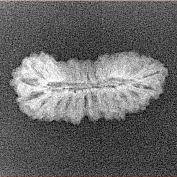 27 Mukhi Rudraksha 22.9mm 1gm - Xray