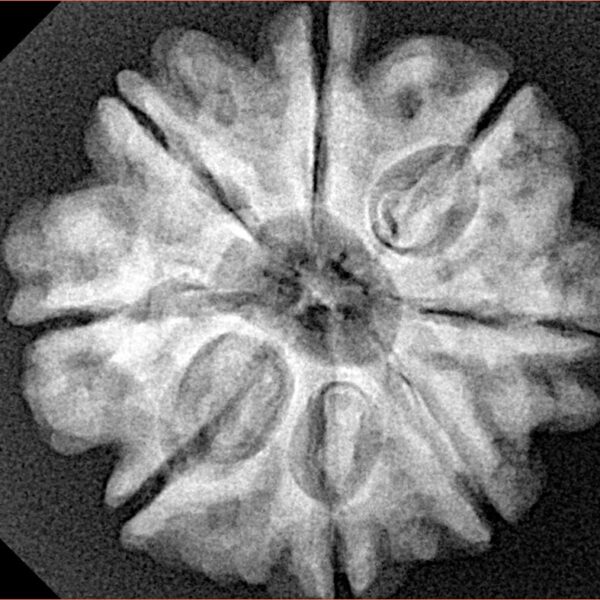 8 Mukhi Rudraksha 25.3mm 5.18gm - Xray