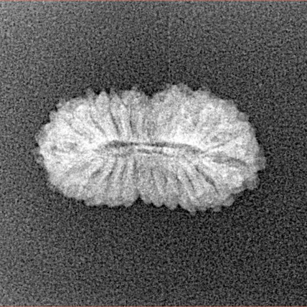 21 Mukhi Rudraksha 19.3mm 1gm - Xray