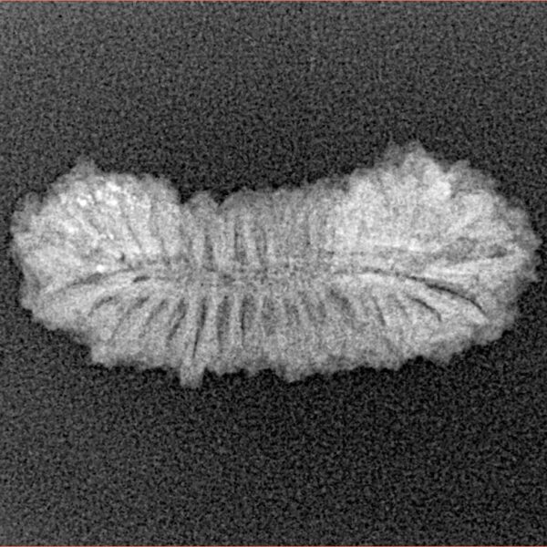 31 Mukhi Rudraksha 24.8mm 1.49gm - Xray