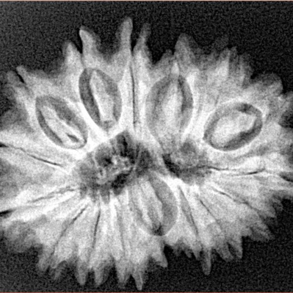 16 Mukhi Rudraksha 28.4mm 5gm - Xray