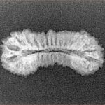 31 Mukhi Rudraksha 25.5mm 1.49gm - Xray