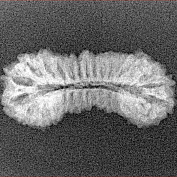 31 Mukhi Rudraksha 25.5mm 1.49gm - Xray