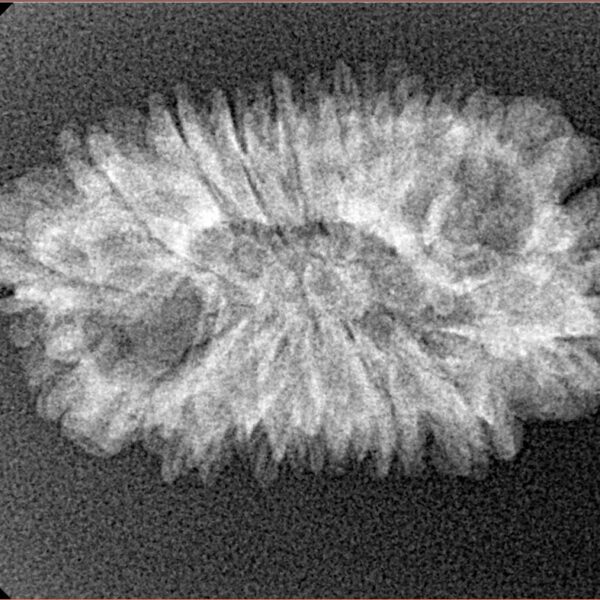 16 Mukhi Rudraksha 28.6mm 2.57gm - Xray