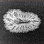 19 Mukhi Rudraksha 22.4mm 2.09gm - Xray
