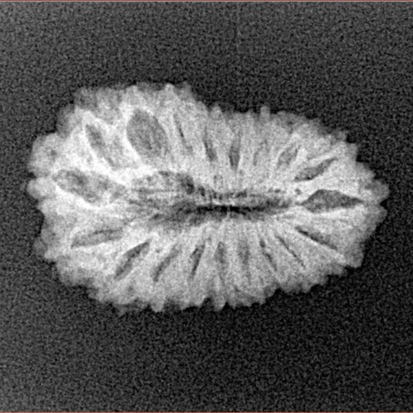 19 Mukhi Rudraksha 22.4mm 2.09gm - Xray