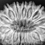 16 Mukhi Rudraksha 34.2mm 7.94gm - Xray